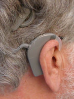 Høreapparat cochlear implant
