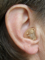 Høreapparat I-øret